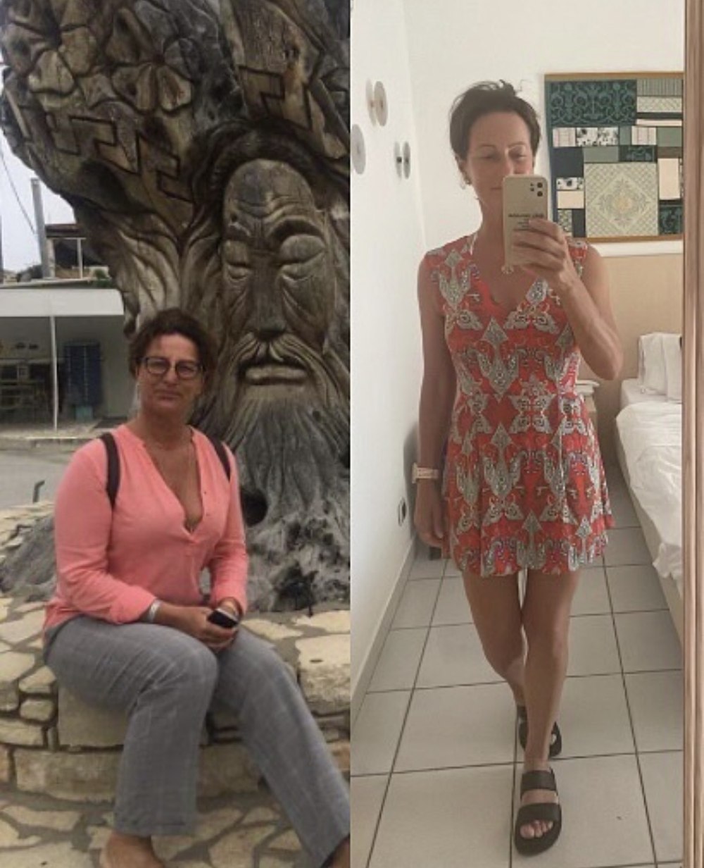 Premena Silvie — porovnanie pred a po